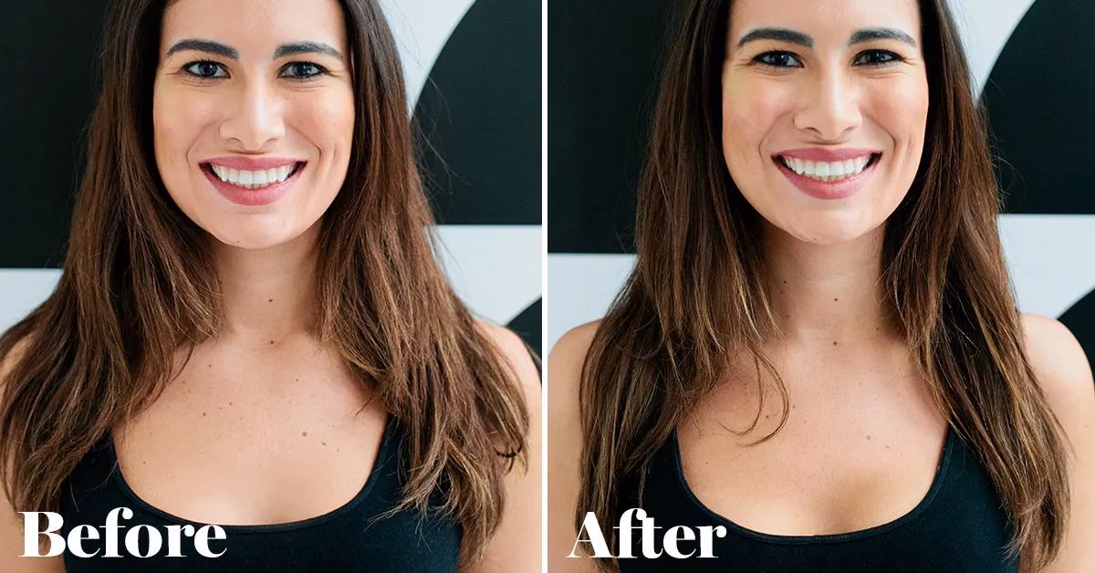 How do you bring cleavage together?