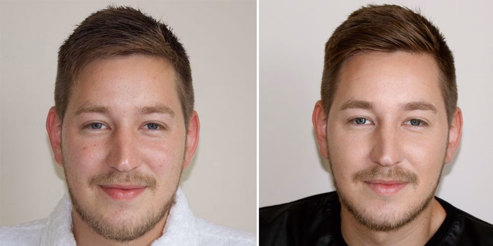 Can straight men use concealer?