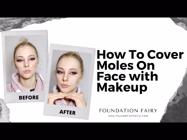 How to hide moles without makeup on face?