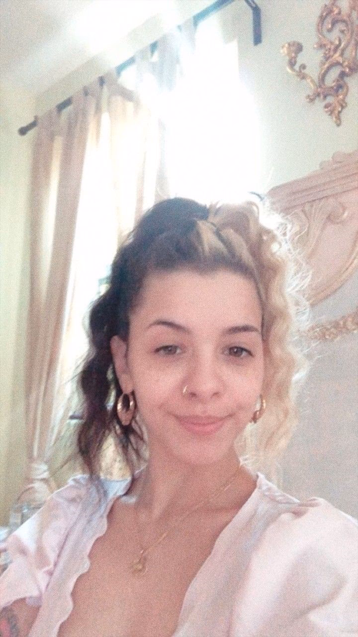 What disability does Melanie Martinez have?