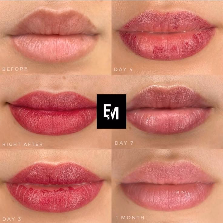 ¿Cuánto tiempo tarda en cicatrizar la micropigmentación de labios?