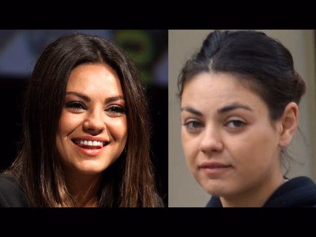 What is the rare condition Mila Kunis eyes?
