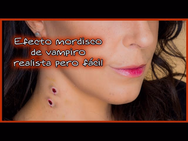 ¿Cómo sanar una mordida en el cuello?