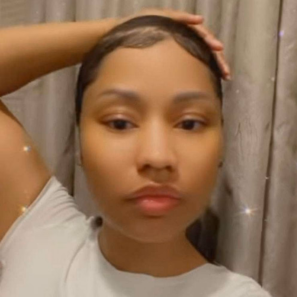 What cosmetic surgery has Nicki Minaj had?