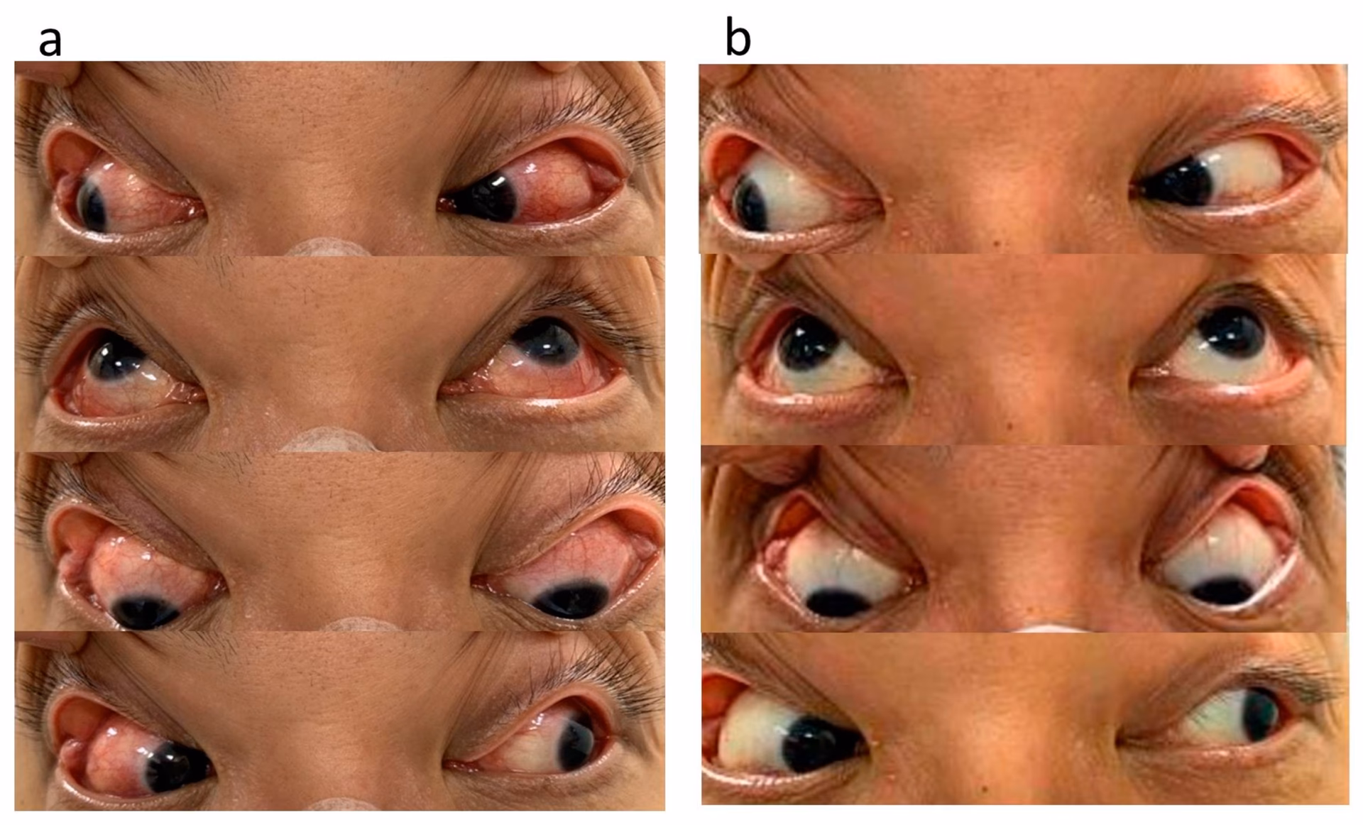 What fluids make up the eye?