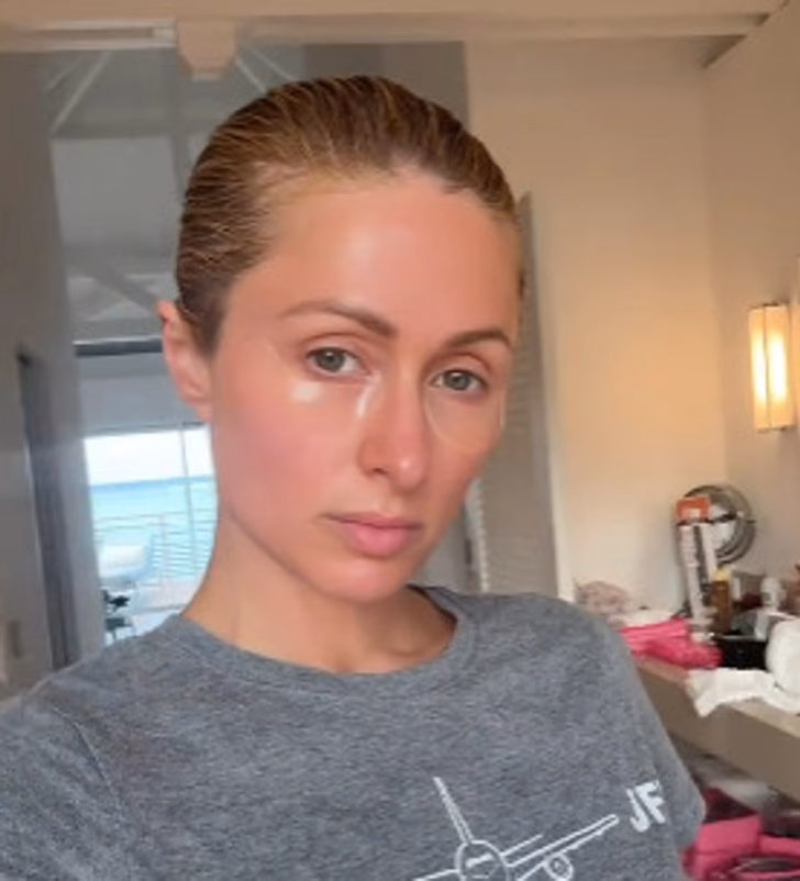 Did Paris Hilton have cosmetic surgery?