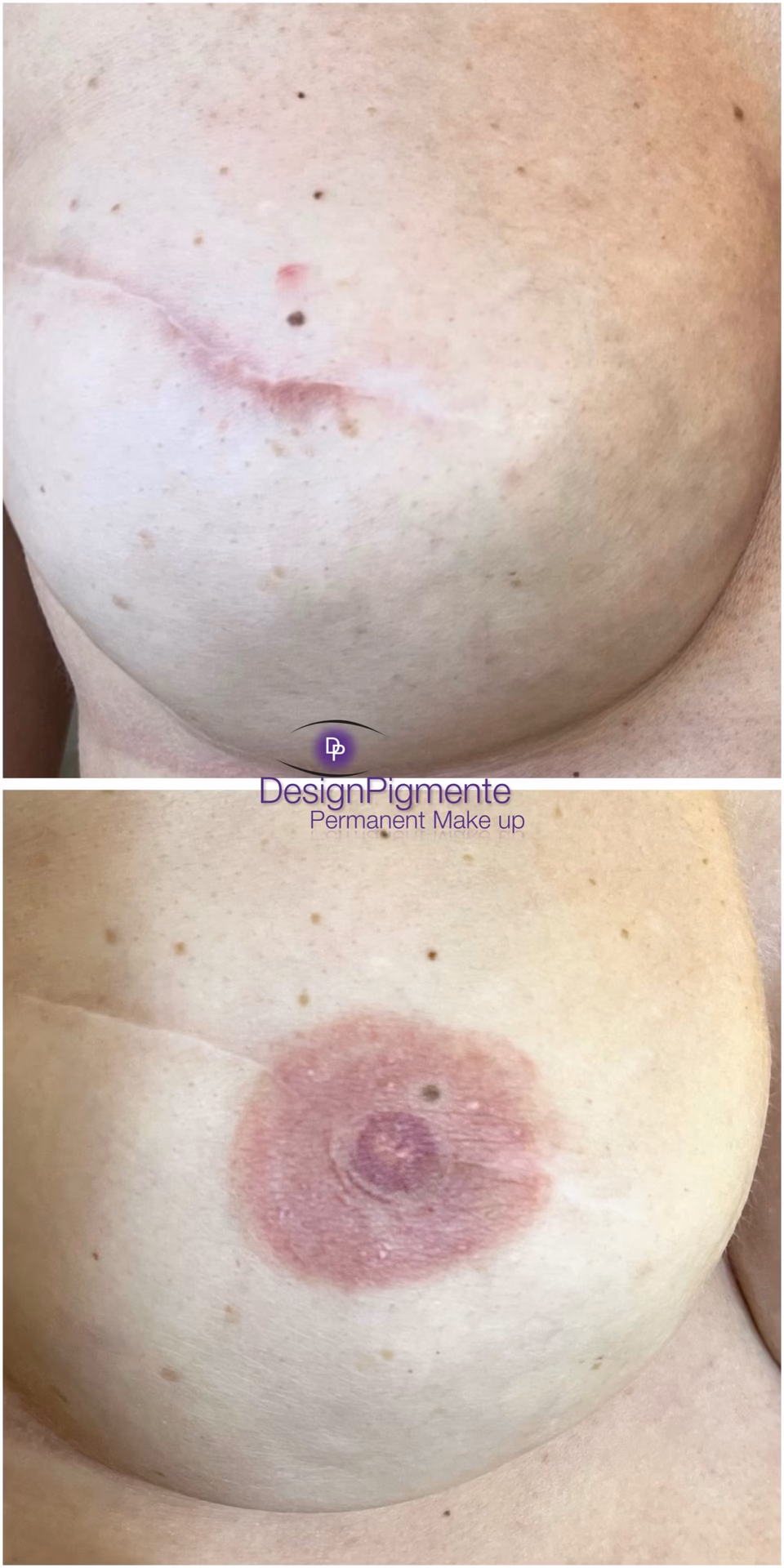 What can go wrong with permanent makeup?