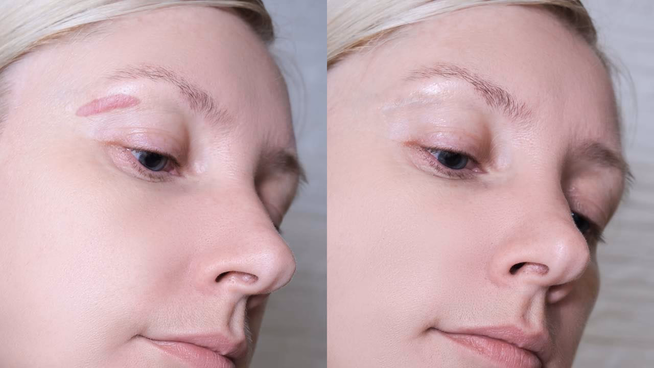Can you be allergic to permanent makeup?