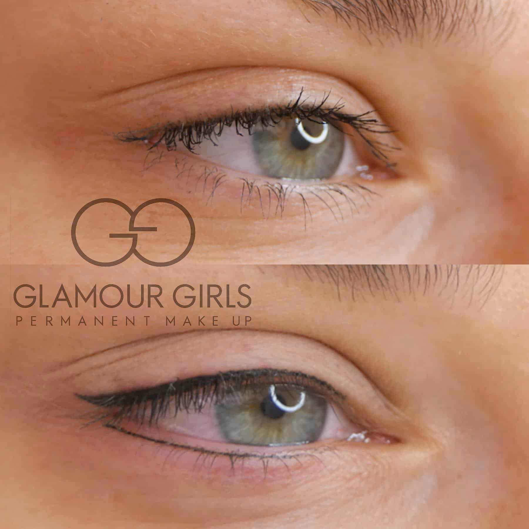 Can you undo permanent makeup?