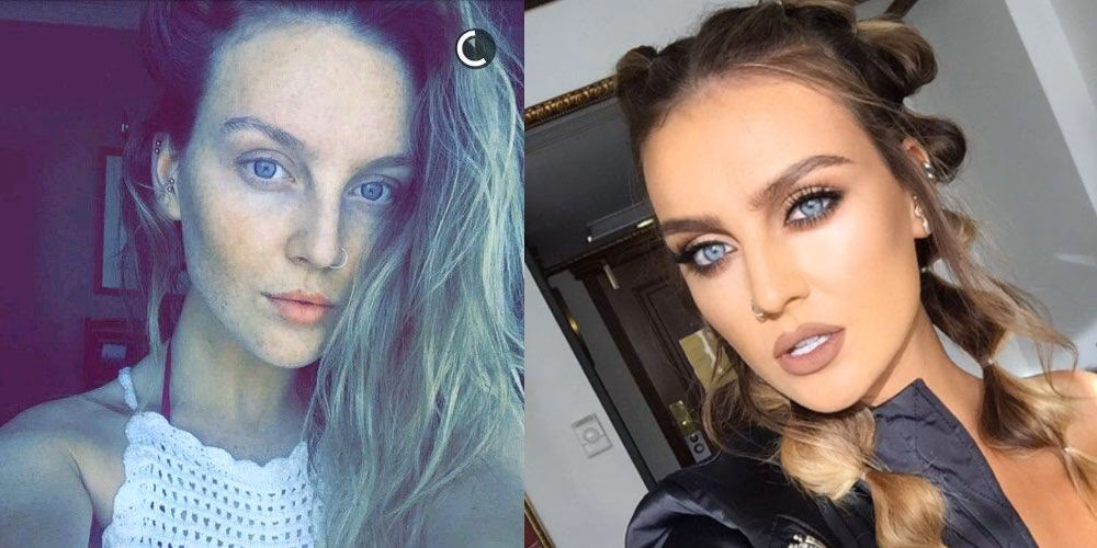 What condition does Perrie Edwards have?