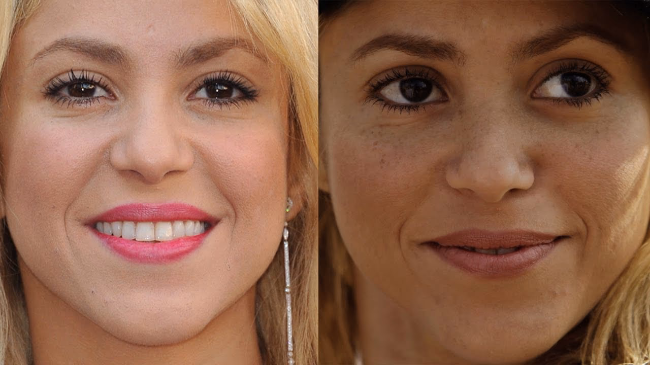 Does Shakira have freckles?