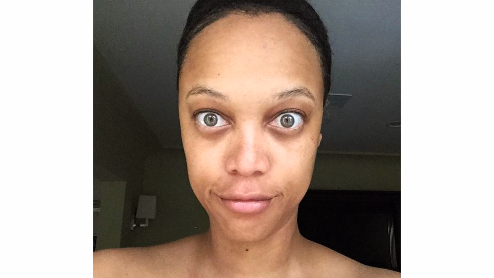 Has Tyra Banks had cosmetic surgery?