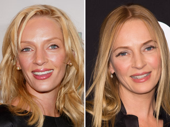 Has Uma Thurman had face work done?
