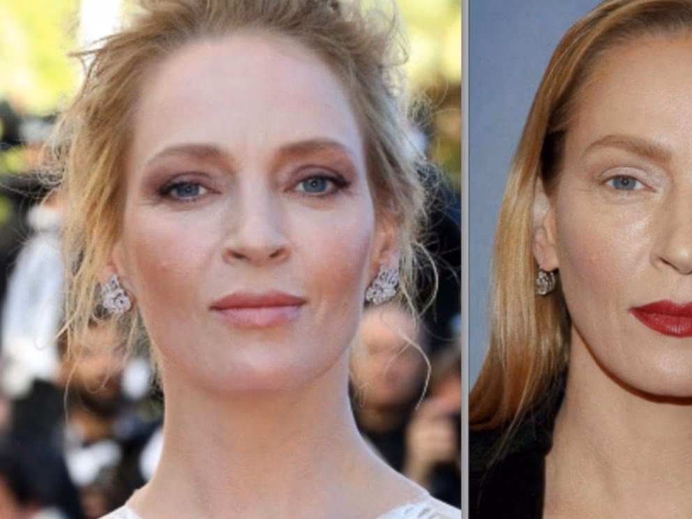 Has Uma Thurman had face work done?