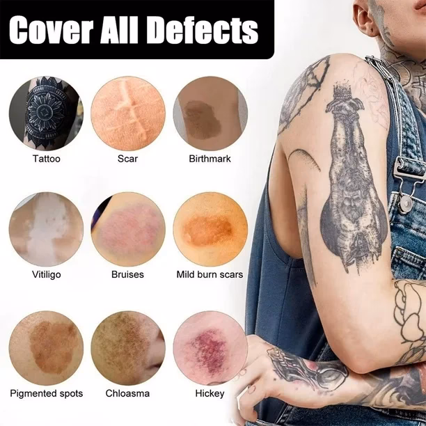 Can you put makeup on vitiligo?