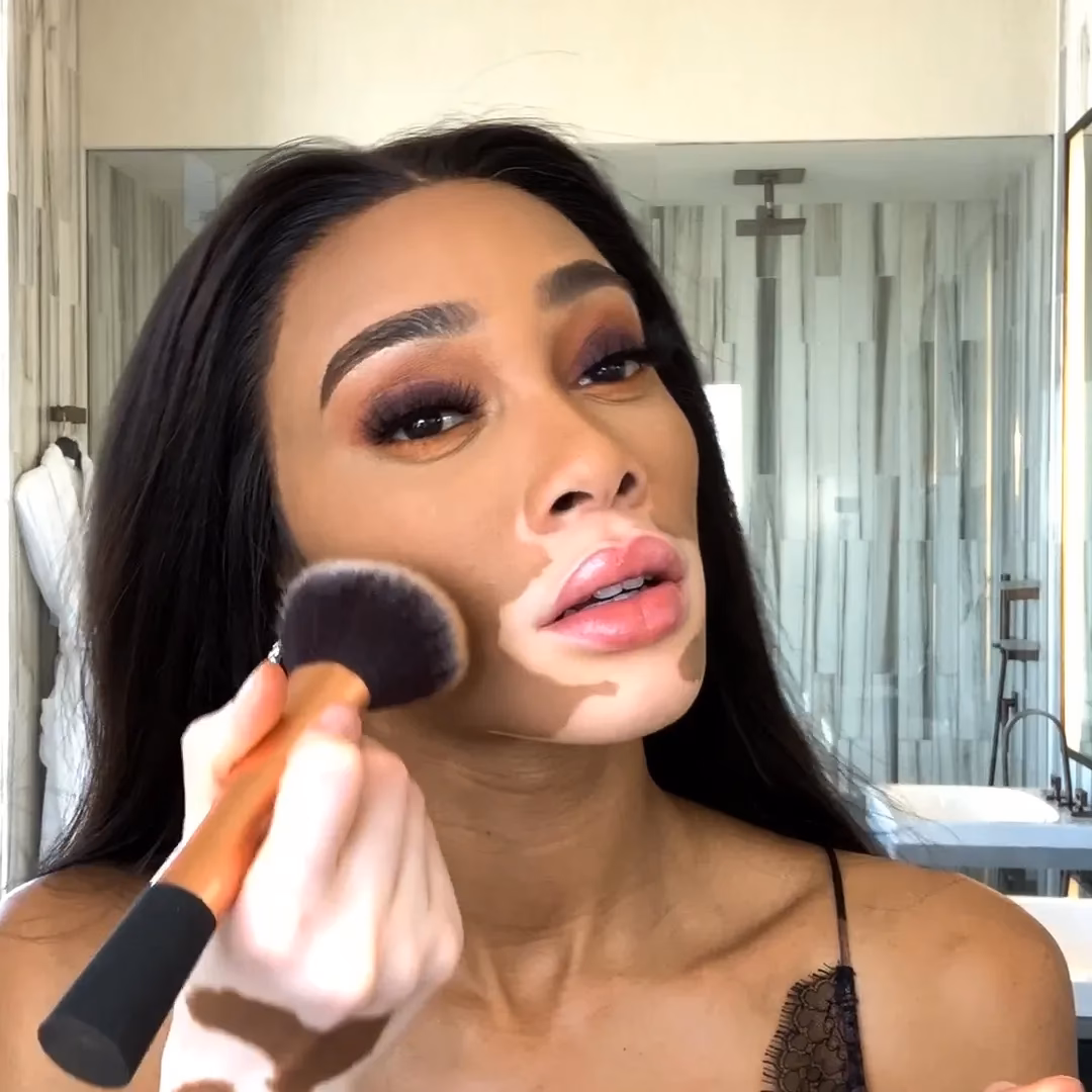 What is Winnie Harlow's skin brand?