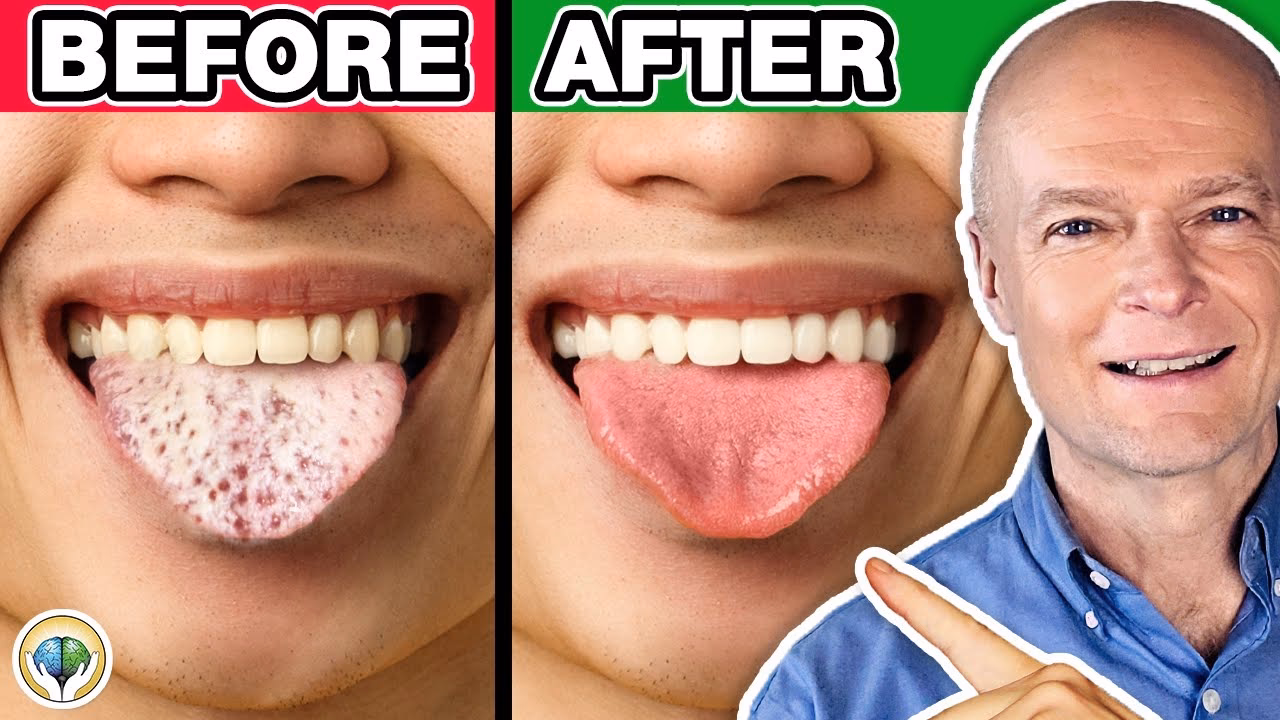 How do you fix Candida on your face?